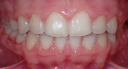 Before & Afters