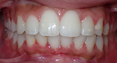 Before & Afters