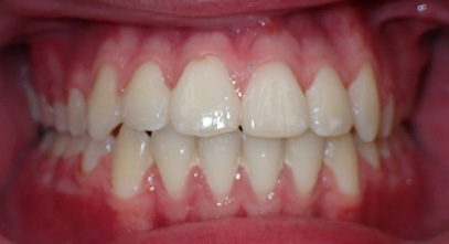 Before & Afters
