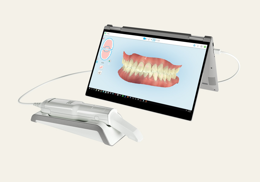 iTero scanner iTero scanner