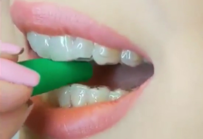 Care for your clear aligners