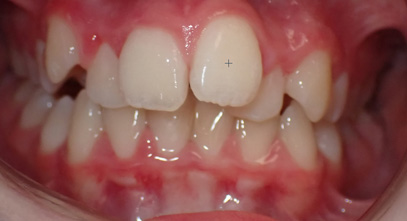Before & Afters