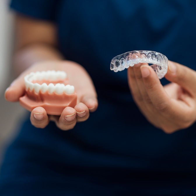 What are Spark aligners What are Spark aligners