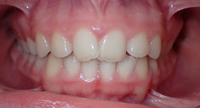 Before & Afters