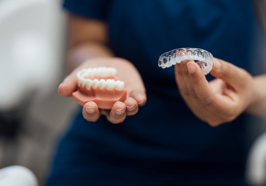 Clear aligners Clear aligners