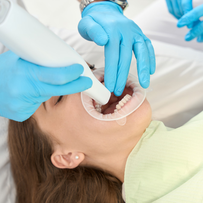 iTero scanning with clear aligners iTero scanning with clear aligners