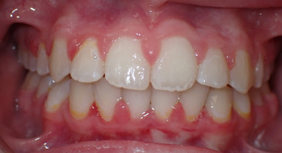 Before & Afters