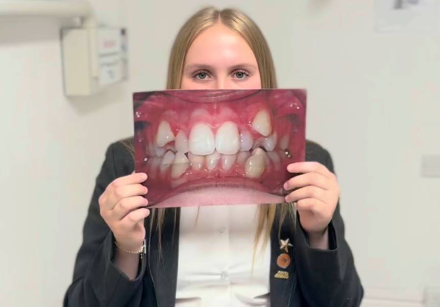 Angel Teen Aligners - a confident smile for growing teens