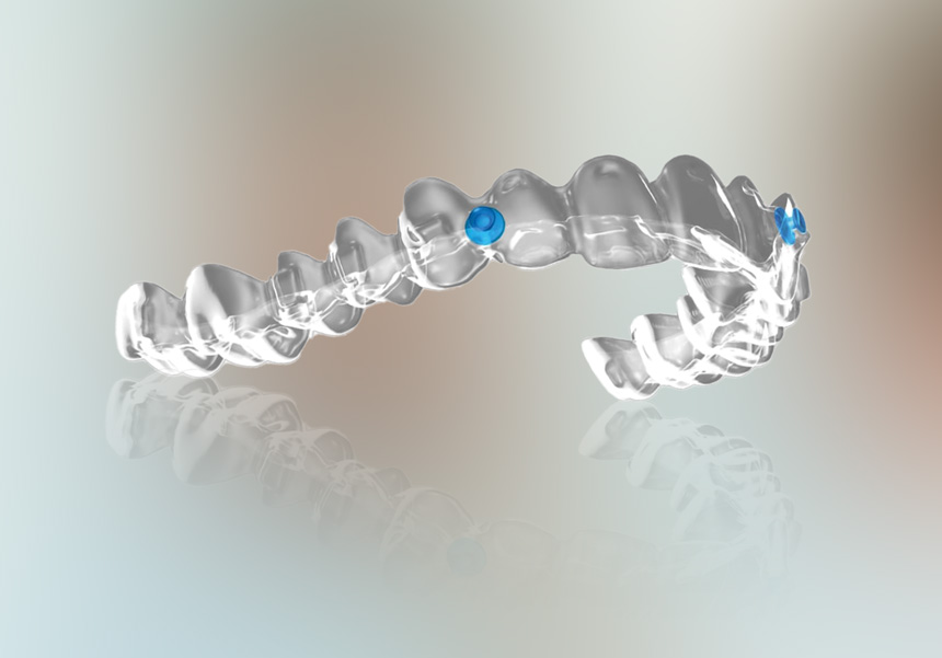 Angel Aligners Angel Aligners