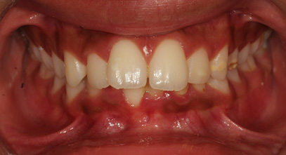 Before & Afters