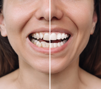 Before & afters