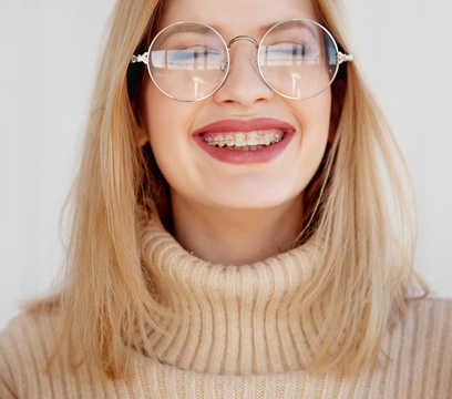 Clear braces
